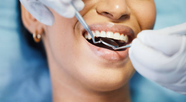 Best Emergency Dental Care for Abscessed Tooth in Roosevelt Gardens, FL